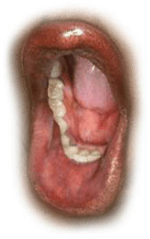 Thumbnail for Mouths